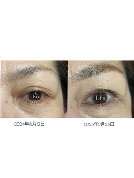 トータルビューティーサロンリア(Li'a)/【40代後半のお客様】