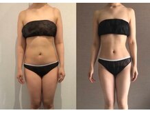 トータルビューティーサロンリア(Li'a)の雰囲気（キャビ×極上リンパで魅せる、洗練された美しいボディラインへ！）