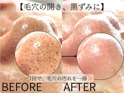 ヒカリエステ 六本木(HIKARI ESTHE)の写真