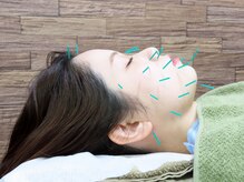 わきさか鍼灸整骨院・鍼灸院 レーヴ(Reve)/電気を流さなくても効果は◎