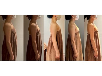 ロココ 豊田店(Rococo)/ビフォーアフター