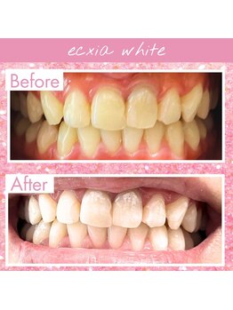 エクシアホワイト SOKA(ecxia white)/