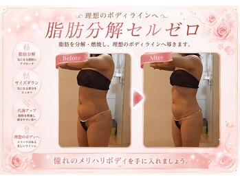 エステティックサロン フェアリー(ESTHETIC SALON FAIRLY)/痩身