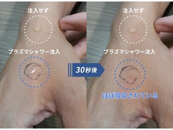 ルーナ(Luna)/プラズマシャワー