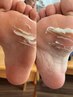 今だけ！べべケアスパ３回/足裏の頑固角質/カチカチのかかとを本格技術で除去