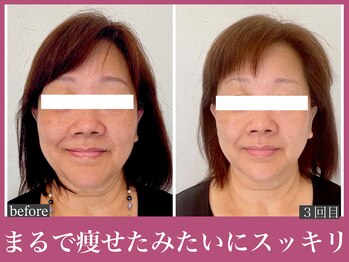 アクアビー(AQUA-B)/