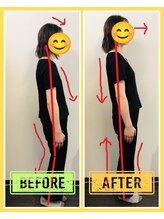 やくいん整骨院 薬院店/姿勢ビフォーアフター