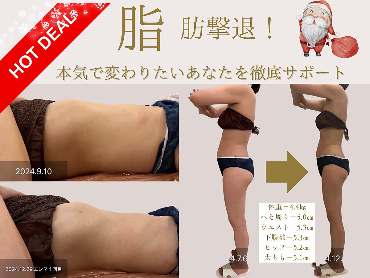 神戸市中央区で痩身が人気のエステサロン｜ホットペッパービューティー