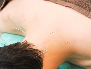 東園田鍼灸整骨院の写真/【腰痛・首肩ケア】ツボ刺激で溜まった疲れを根本改善！不調知らずの身体へ導く本格メンテナンス施術☆