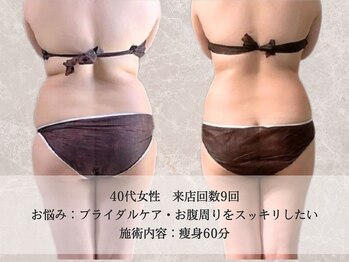 エクストリミティ 国立店(EXTREMITY)/お客様の変化