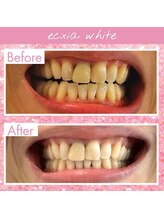 エクシアホワイト SOKA(ecxia white)/