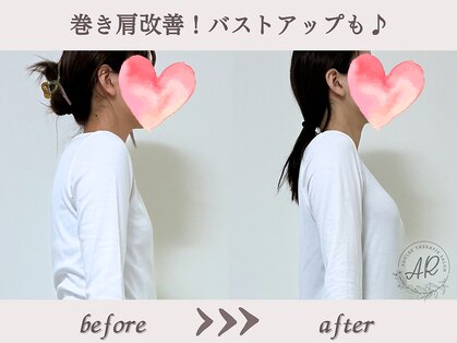 エーアール(AR)の写真