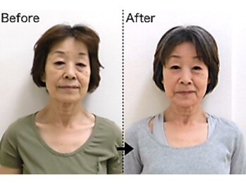 美容整体すこやかの写真/たるみ・ほうれい線ケアに◎顔は身体の状態を表すモニター♪内臓の機能アップ整体でキュッと引き締まる！
