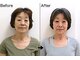 美容整体すこやかの写真/たるみ・ほうれい線ケアに◎顔は身体の状態を表すモニター♪内臓の機能アップ整体でキュッと引き締まる！