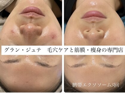グラン ジュテの写真