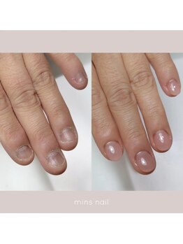 ミンスネイル(Mins Nail)/