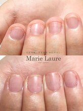 マリーロール 淀屋橋本店(Marie Laure)/自爪育成/深爪矯正/ネイルケア