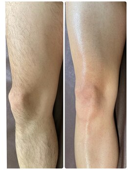 エン(en.)/BeforeAfter写真46