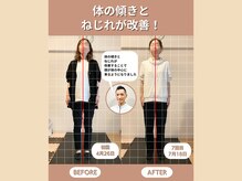 スペックフィジカルコンディショニング(SPECフィジカルコンディショニング)/40代女性/姿勢ビフォーアフター