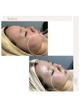 fallon beauty　痩身/フェイシャル/フェム・オムケア/アロマ/ボディケア/ハーブピーリング