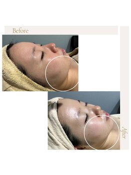 fallon beauty　痩身/フェイシャル/フェム・オムケア/アロマ/ボディケア/ハーブピーリング