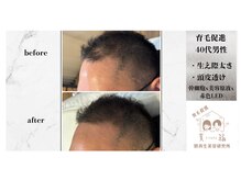 美箱 赤坂店/40代からの育毛促進