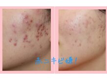 キッカ 梅田天六(Kikka)/心配になる程