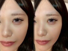 Aminyパリジェンヌ/バインドロック/フラットラッシュ/LED/マツエク/まつげパーマ/眉毛/まつげエクステ/マツエク/新宿