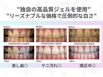 ホワイトニングショップ 池田店の写真