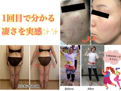 ヨサパーク オハナ(YOSA PARK ohana)の写真