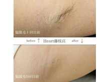 ハート 藤枝店(Heart)の雰囲気（【ジュニアフィルター使用】お子様の肌にも優しくアプローチ）