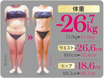 ビューティークリニックコダマ 国分店の写真/凸凹脂肪燃焼で本気痩せ◎最後のダイエットはコダマで！ストレスなくリバウンドしないお身体へ！