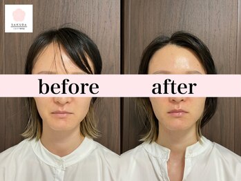 サクラ(SAKURA)/30代前半子育て中でも綺麗に◎