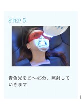 ホワイトニングショップ 桜木町店/【ステップ5】