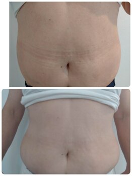 ソラ(SORA)/バストを残してダイエット