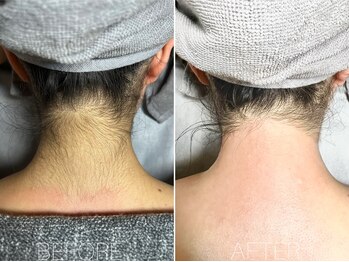 エヴァワックス 銀座店(Eva Wax)/【ブライダル準備に】うなじ背中