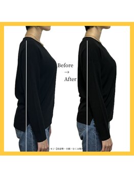 美容整体 レモン/疲れにくく浮腫みにくい身体に