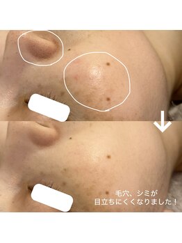 エミュ(e'mu)/都心レベルの結果重視エステ