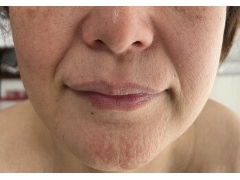 ピュアージュ/神業エイジング▼輪郭/前