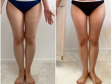 サロン ド メタセコイア(salon de Metasequoia)の雰囲気（痩身ダイエットもお任せください《痩身機器、食事指導など》）