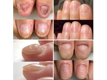 ニューネイル(NEW☆NAIL)