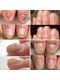 ニューネイル(NEW☆NAIL)の写真/爪の形は変えられる？！当店は【飾る】ではなく、自爪を【育てる】サロン☆爪のお悩みご相談ください◎