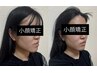 【回数券】医師推奨の小顔矯正5回¥25000