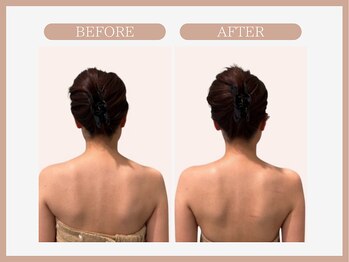 アコガレコガオ 八戸店/