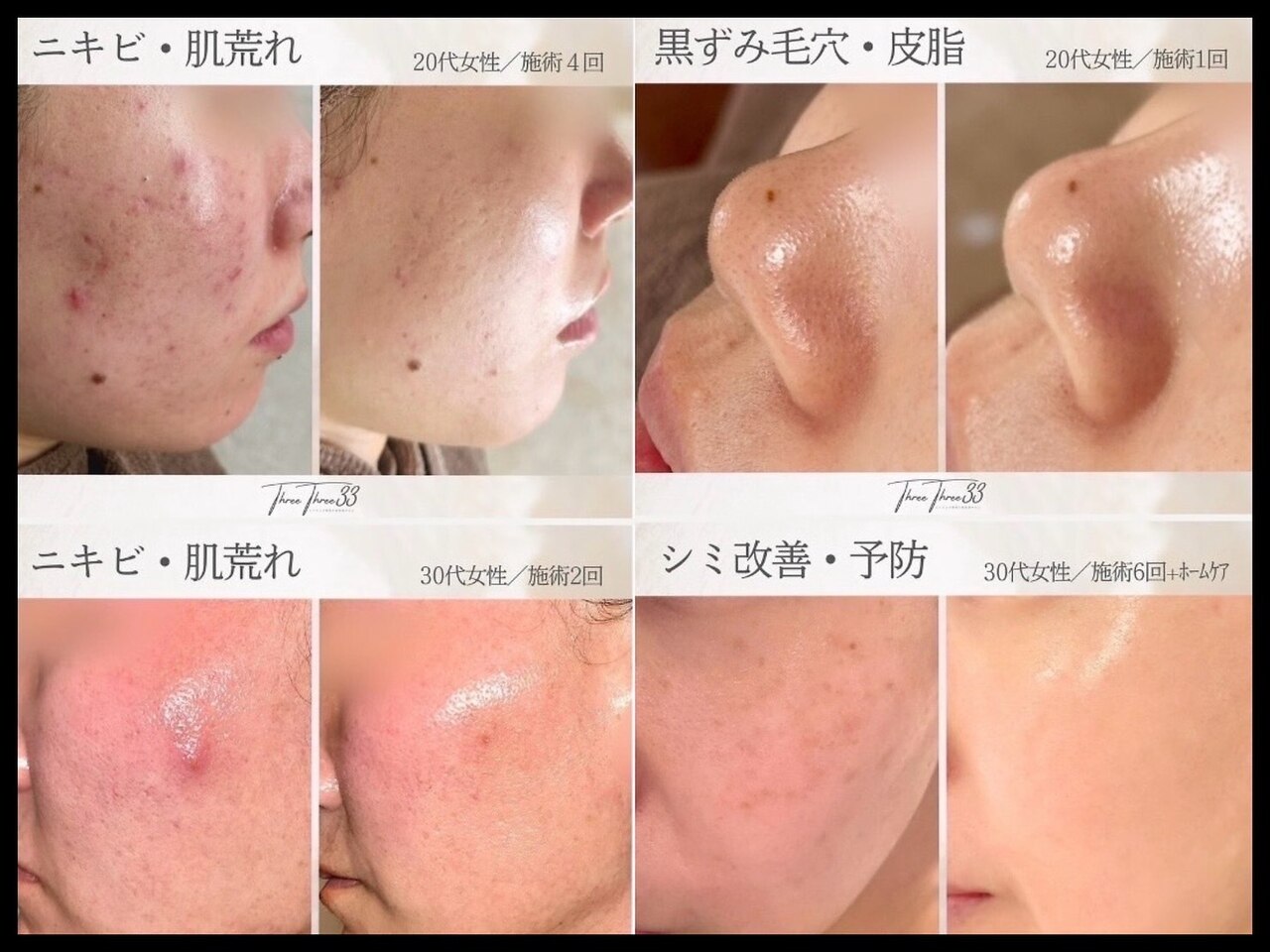 ゾーンビューティーハウス 松戸店(ZONE BEAUTY HOUSE)｜ホットペッパー