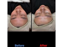 クラルテアンドコー(Salon Clarte&Co.)/NUCLAIREフェイシャルワックス