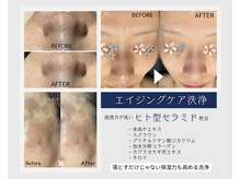 泡のきもち/洗浄＆浸透で変える美肌づくり