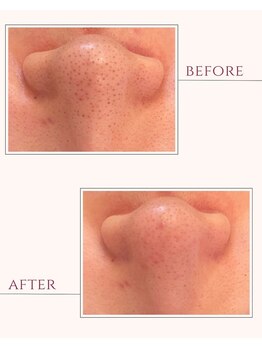 アワイズ(AY's)/その汚れいつから放置してる?