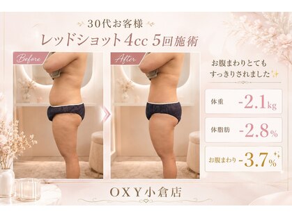 オキシー グレイス 小倉店(OXY Grace)の写真