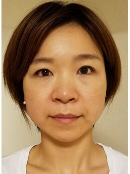 美姿勢☆倶楽部　ずくだし屋/リフトアップ↑小顔♪